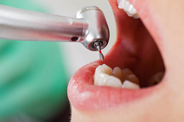 Best Emergency Cosmetic Dentistry (e.g., broken veneers) in Norris City, IL